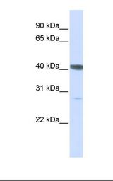 HepG2 cell lysate. Antibody concentration: 1.0 ug/ml. Gel concentration: 12%.