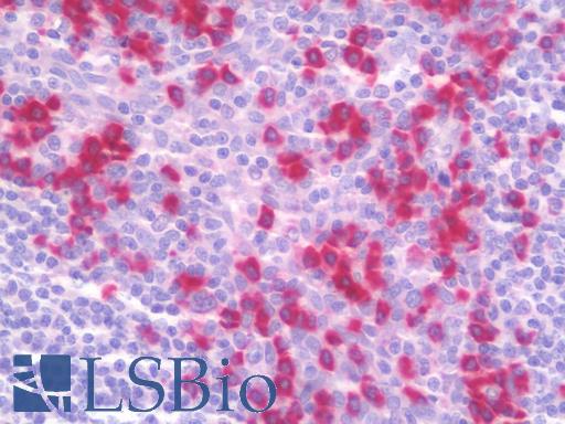 Anti-DNAJB11 antibody IHC staining of human tonsil. Immunohistochemistry of formalin-fixed, paraffin-embedded tissue after heat-induced antigen retrieval. Antibody LS-B9732 concentration 10 ug/ml.