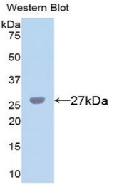 Western blot of recombinant CHI3L1 / YKL-40.