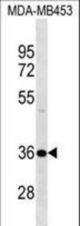 DNAJB2 Antibody western blot of MDA-MB453 cell line lysates (35 ug/lane). The DNAJB2 antibody detected the DNAJB2 protein (arrow).