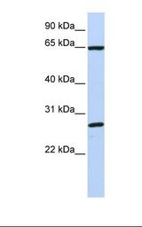 MCF7 cell lysate. Antibody concentration: 1.0 ug/ml. Gel concentration: 12%.