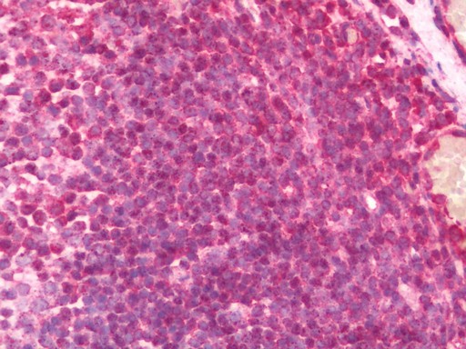 Human Tonsil: Formalin-Fixed, Paraffin-Embedded (FFPE) 