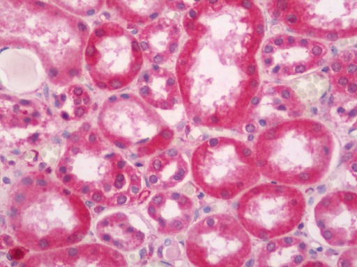 Human Kidney: Formalin-Fixed, Paraffin-Embedded (FFPE)