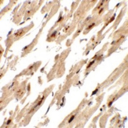 Immunohistochemistry of DNAJC13 in human heart tissue with DNAJC13 antibody at 5 ug/ml.