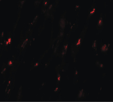 Immunofluorescence of DNAJC13 in human heart tissue with DNAJC13 antibody at 20 ug/ml.