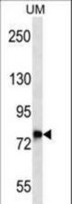DNAJC14 Antibody western blot of uterus tumor cell line lysates (35 ug/lane). The DNAJC14 antibody detected the DNAJC14 protein (arrow).