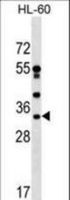 DNAJC17 Antibody western blot of HL-60 cell line lysates (35 ug/lane). The DNAJC17 antibody detected the DNAJC17 protein (arrow).