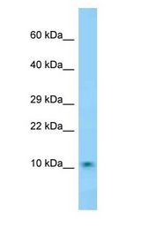 DNAJC19 antibody Western Blot of Mouse Brain.