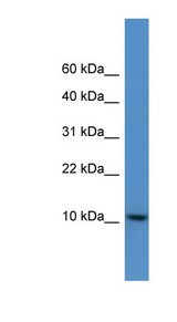 DNAJC19 antibody LS-C135629 Western blot of Placenta lysate.