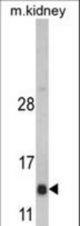 Western blot of DNAJC19 Antibody in mouse kidney tissue lysates (35 ug/lane). DNAJC19 (arrow) was detected using the purified antibody.