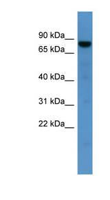 DNAJC2 antibody LS-C135643 Western blot of Fetal Liver lysate.