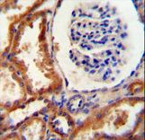 DNAJC22 antibody immunohistochemistry of formalin-fixed and paraffin-embedded human kidney tissue followed by peroxidase-conjugated secondary antibody and DAB staining.