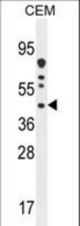 DNAJC22 Antibody western blot of CEM cell line lysates (35 ug/lane). The DNAJC22 antibody detected the DNAJC22 protein (arrow).