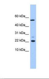 Fetal liver lysate. Antibody concentration: 1.0 ug/ml. Gel concentration: 10-20%.