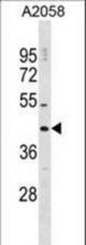 DNAJC25 Antibody western blot of A2058 cell line lysates (35 ug/lane). The DNAJC25 antibody detected the DNAJC25 protein (arrow).
