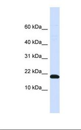 Placenta lysate. Antibody concentration: 1.0 ug/ml. Gel concentration: 10-20%.