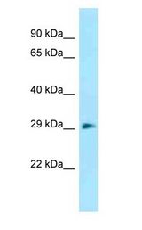 DNAJC27 antibody Western Blot of Mouse Kidney.