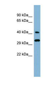DNAJC27 antibody LS-C107663 Western blot of Fetal Kidney lysate.