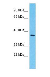 Western blot of DNAJC28 Antibody with human 721_B Whole Cell lysate.