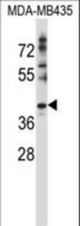 DNAJC28 Antibody western blot of MDA-MB435 cell line lysates (35 ug/lane). The DNAJC28 antibody detected the DNAJC28 protein (arrow).
