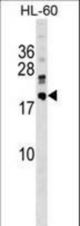 DNAJC30 Antibody western blot of HL-60 cell line lysates (35 ug/lane). The DNAJC30 antibody detected the DNAJC30 protein (arrow).
