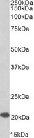 DNAJC5 antibody (0.1 ug/ml) staining of Human Cerebellum lysate (35 ug protein in RIPA buffer). Primary incubation was 1 hour. Detected by chemiluminescence.
