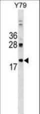 DNAJC5 Antibody western blot of Y79 cell line lysates (35 ug/lane). The DNAJC5 antibody detected the DNAJC5 protein (arrow).