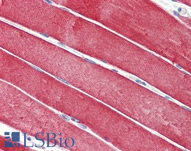 Anti-DNAJC5 / CSP antibody IHC staining of human skeletal muscle. Immunohistochemistry of formalin-fixed, paraffin-embedded tissue after heat-induced antigen retrieval. Antibody LS-B9564 concentration 5 ug/ml.