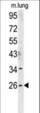 DNJC8 Antibody western blot of mouse lung tissue lysates (15 ug/lane). The DNJC8 antibody detected DNJC8 protein (arrow).