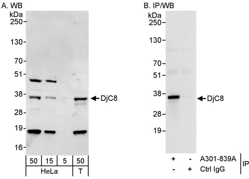 Detection of Human DjC8 by Western Blot and Immunoprecipitation. Samples: Whole cell lysate from HeLa (50 ug for WB; 1 mg for IP, 20% of IP loaded) and 293T (T; 50 ug) cells. Antibodies: Affinity purified rabbit anti-DjC8 antibody used for WB at 0.04 ug/ml (A) and 1 ug/ml (B) and used for IP at 3 ug/mg lysate. Detection: Chemiluminescence with exposure times of 3 minutes (A) and 3 seconds (B).