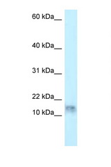 DNAL1 antibody LS-C145682 Western blot of HepG2 Cell lysate. Antibody concentration 1 ug/ml.