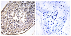 IHC of paraffin-embedded human testis tissue, using DNAL4 Antibody. The sample on the right was incubated with synthetic peptide.
