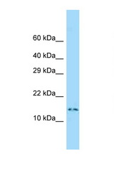 DNAL4 antibody LS-C146418 Western blot of Small Intestine lysate. Antibody concentration 1 ug/ml.