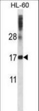 DNAL4 Antibody western blot of HL-60 cell line lysates (35 ug/lane). The DNAL4 antibody detected the DNAL4 protein (arrow).