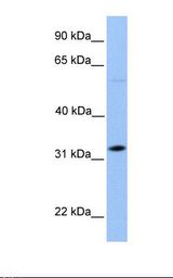 721_B cell lysate. Antibody concentration: 1.0 ug/ml. Gel concentration: 12%.