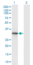 Western Blot analysis of DNALI1 expression in transfected 293T cell line by DNALI1 monoclonal antibody (M04A), clone 2H3.Lane 1: DNALI1 transfected lysate (Predicted MW: 29.7 KDa).Lane 2: Non-transfected lysate.