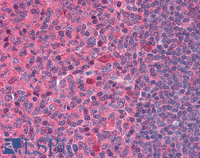 Anti-DNase I antibody IHC of human tonsil. Immunohistochemistry of formalin-fixed, paraffin-embedded tissue after heat-induced antigen retrieval. Antibody LS-B4846 concentration 10 ug/ml.