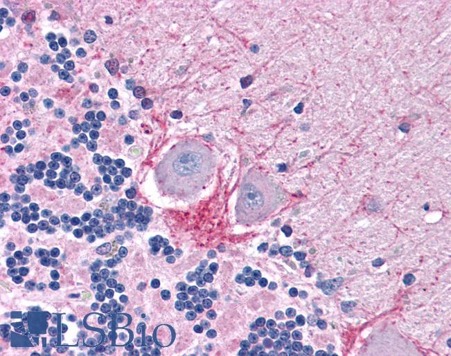 Anti-DNase I antibody IHC of human brain, cerebellum. Immunohistochemistry of formalin-fixed, paraffin-embedded tissue after heat-induced antigen retrieval. Antibody LS-B4846 concentration 10 ug/ml.