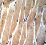 CLEC4F Antibody immunohistochemistry of formalin-fixed and paraffin-embedded human skeletal muscle followed by peroxidase-conjugated secondary antibody and DAB staining.