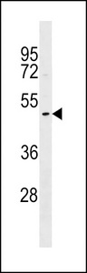 DNASE1L1 Antibody western blot of A549 cell line lysates (35 ug/lane). The DNASE1L1 antibody detected the DNASE1L1 protein (arrow).