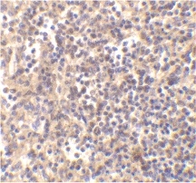 Immunohistochemistry of human spleen with Rabbit anti-DNASE-II