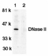 Western blot of human spleen lysate probed with Rabbit anti-Human DNASE-II either in the absence (1) or presence (2) of blocking peptide