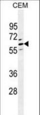 CLEC4F Antibody western blot of CEM cell line lysates (35 ug/lane). The CLEC4F antibody detected the CLEC4F protein (arrow).