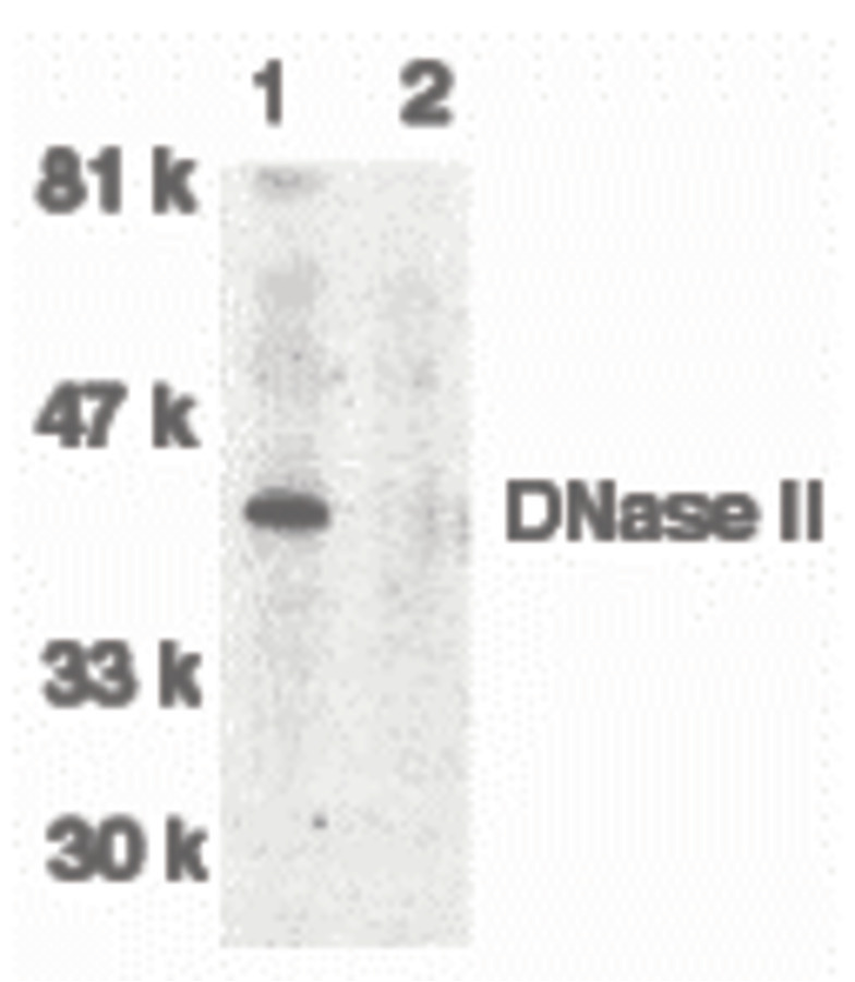 Western blot of DNase II in human spleen tissue lysate in the absence (lane 1) or presence (lane 2) of blocking peptide with DNase antibody II at 1:500 dilution.
