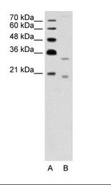 A: Marker, B: Jurkat Cell Lysate