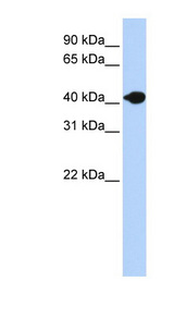 DNASE2B antibody LS-C101978 Western blot of Fetal Muscle lysate.