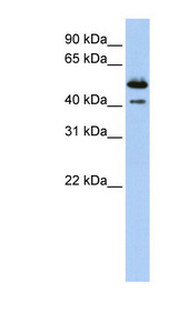 DNASE2B antibody LS-C101979 Western blot of Placenta lysate.