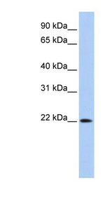 DNASE2B antibody LS-C110703 Western blot of 293T cell lysate.