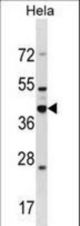 DND1 Antibody western blot of HeLa cell line lysates (35 ug/lane). The DND1 antibody detected the DND1 protein (arrow).