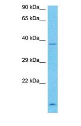 Western blot of DND1 Antibody with human RPMI-8226 Whole Cell lysate.